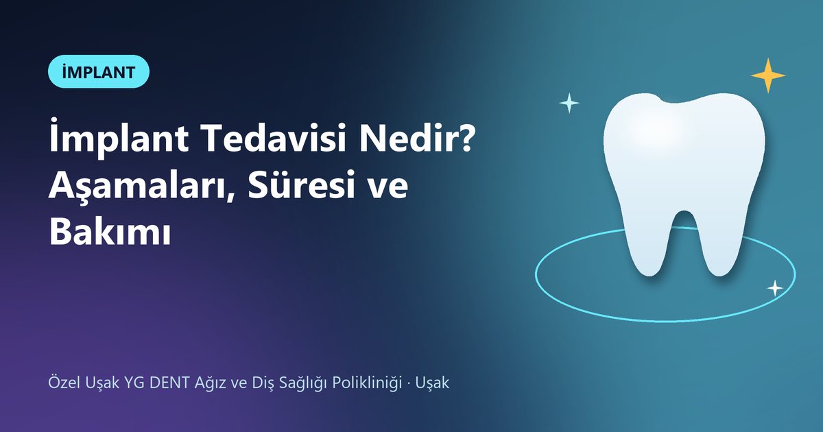 İmplant Tedavisi Nedir? Aşamaları, Süresi ve Bakımı – YG Dent blog kapak görseli