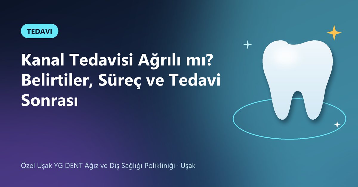 Kanal Tedavisi Ağrılı mı? Belirtiler, Süreç ve Tedavi Sonrası – YG Dent blog kapak görseli